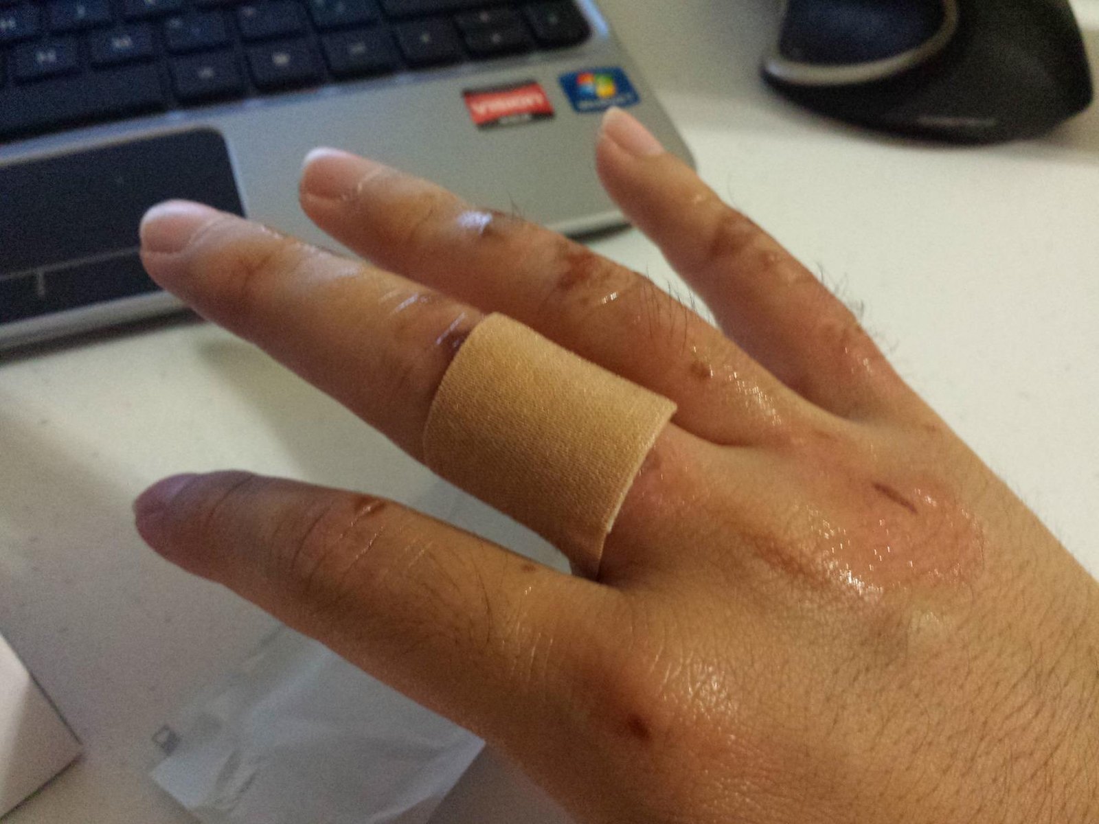 Band-Aid Brand Flexible Fabric Adhesive Bandages. Comfortable Flexible Protection & Wound Care of Minor Cuts & Scrapes. Quilt-Aid Technology to Cushion Painful Wounds. All One Size. 30 ct photo review