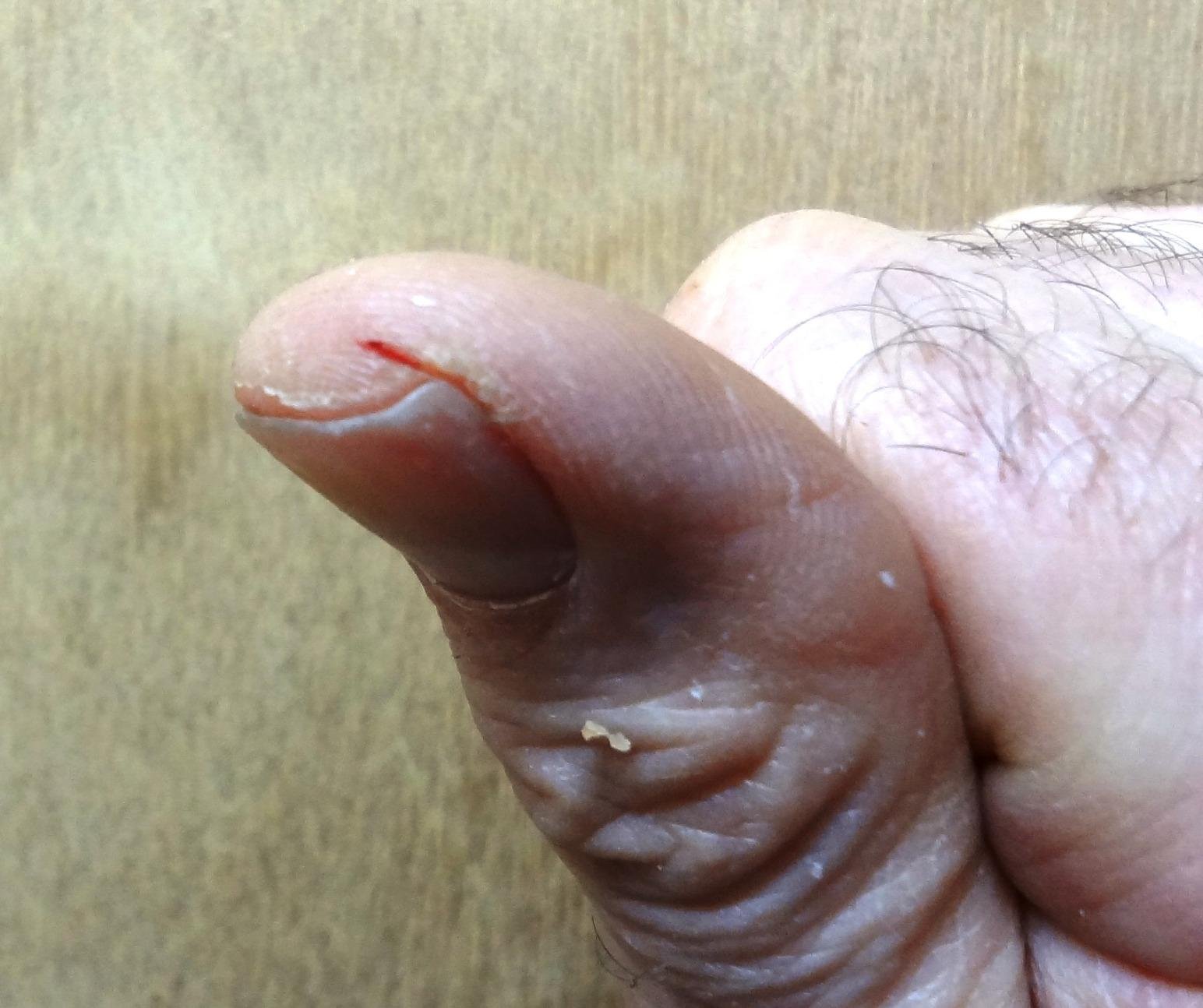 Band-Aid Brand Flexible Fabric Adhesive Bandages. Comfortable Flexible Protection & Wound Care of Minor Cuts & Scrapes. Quilt-Aid Technology to Cushion Painful Wounds. All One Size. 30 ct photo review